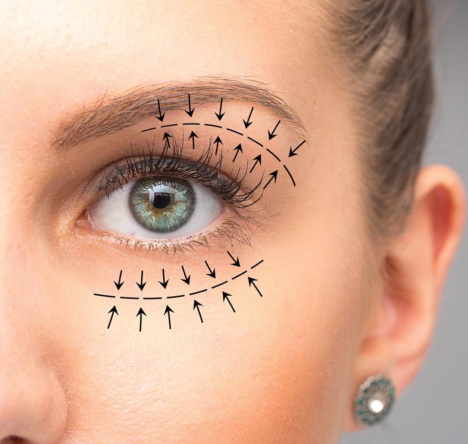 Eyelids Lift Blepharoplasty