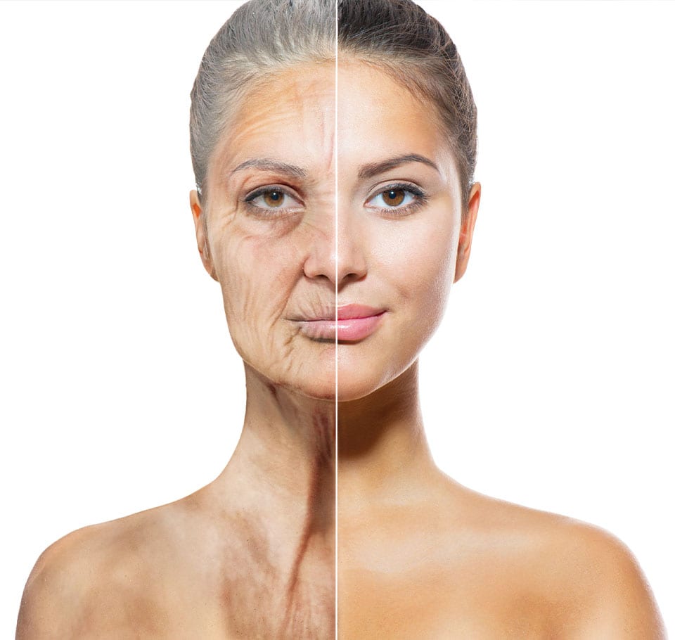 Body Ageing