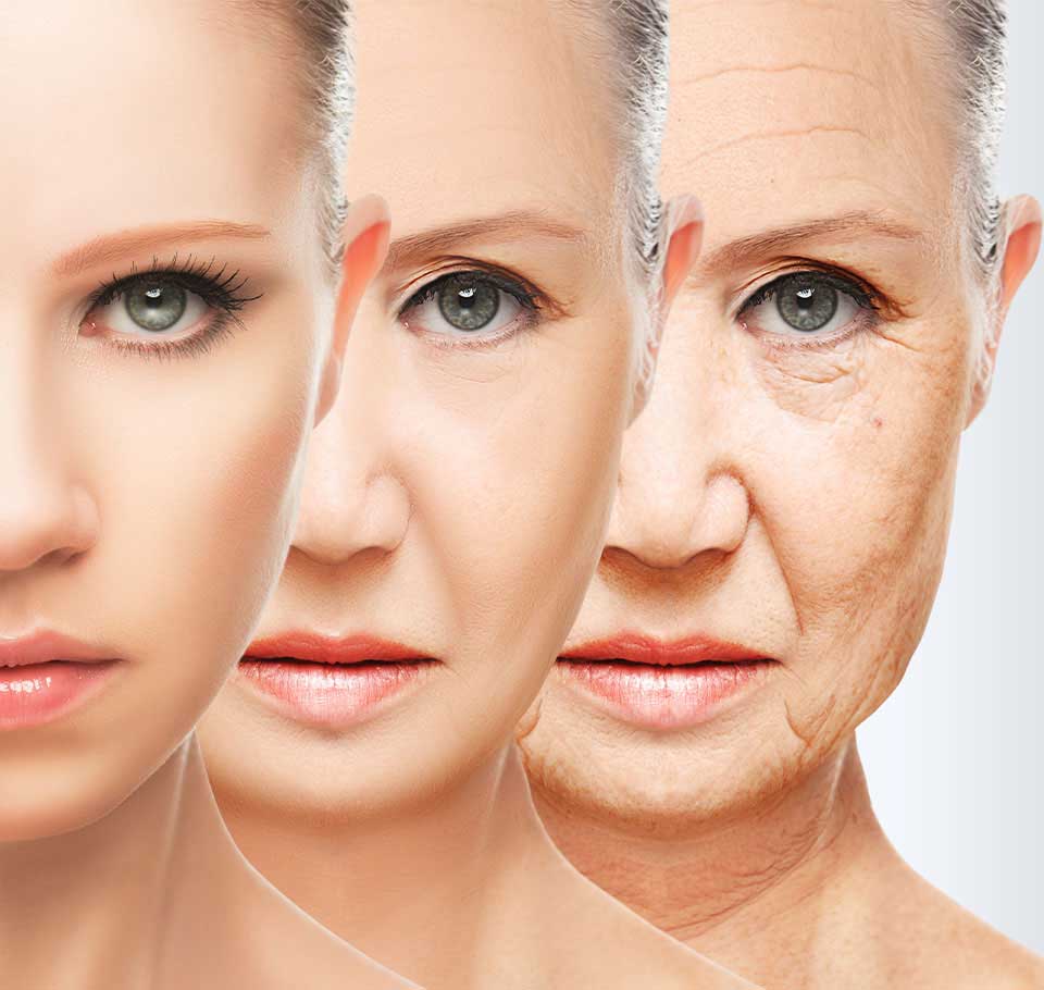 Facial Ageing