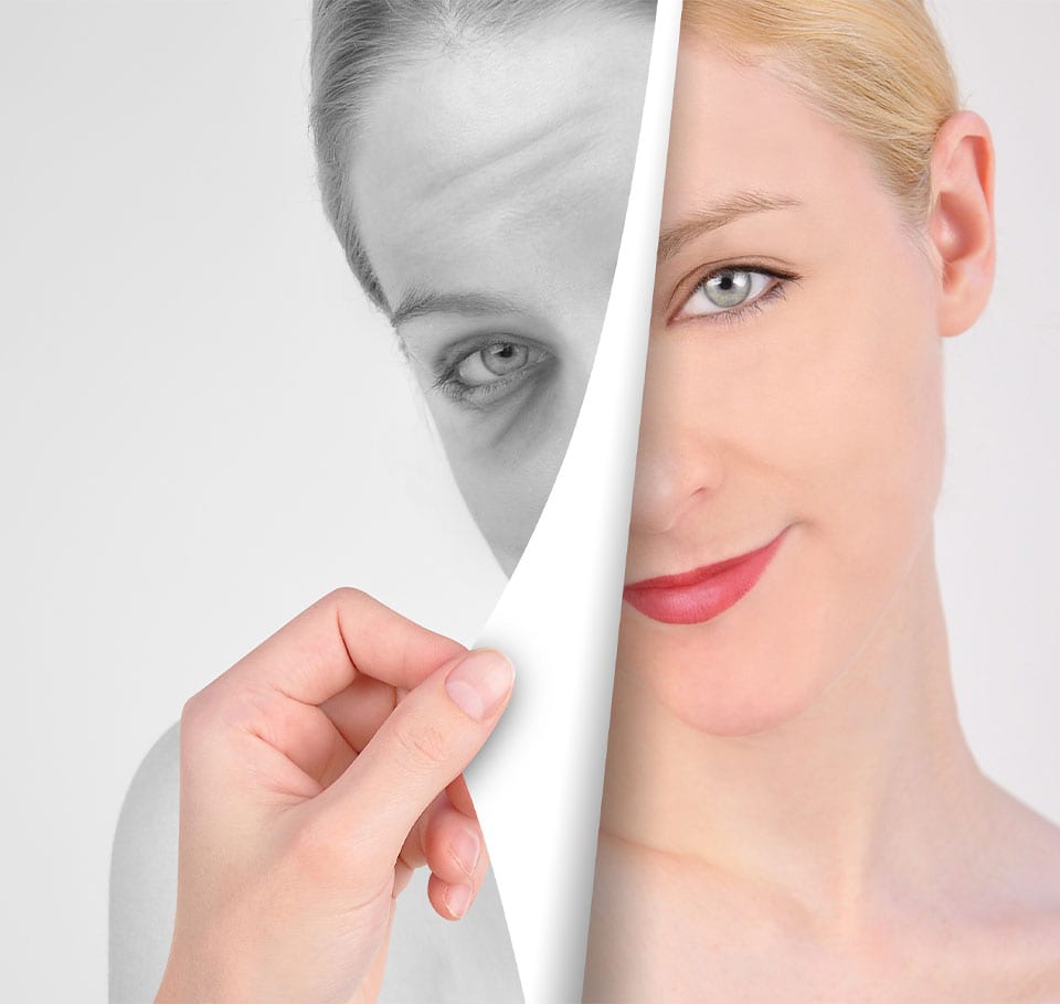 Skin Ageing