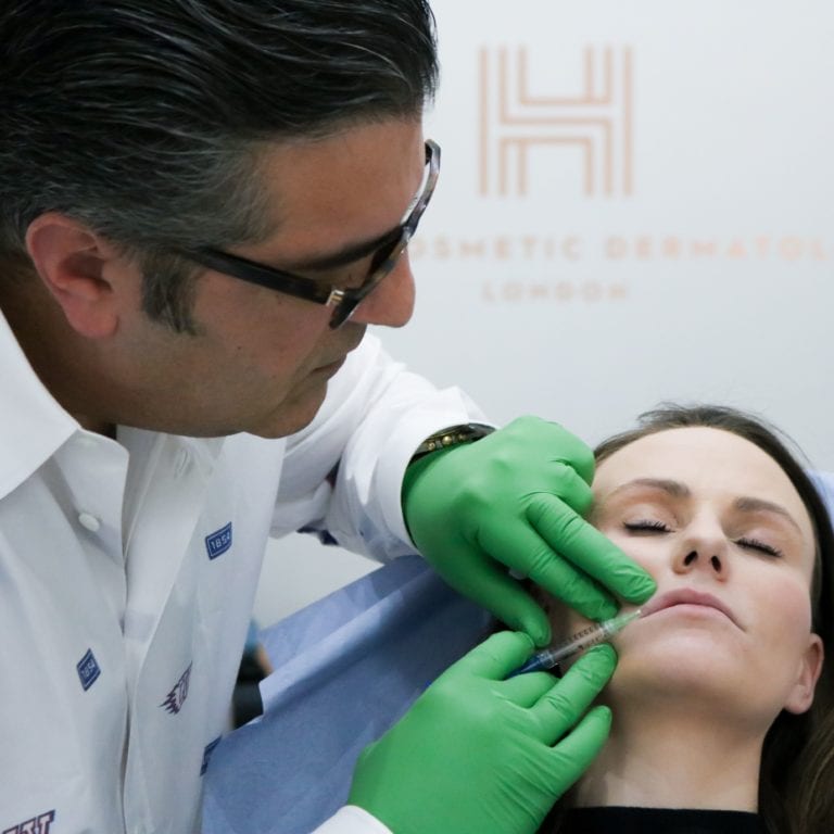 lip fillers london