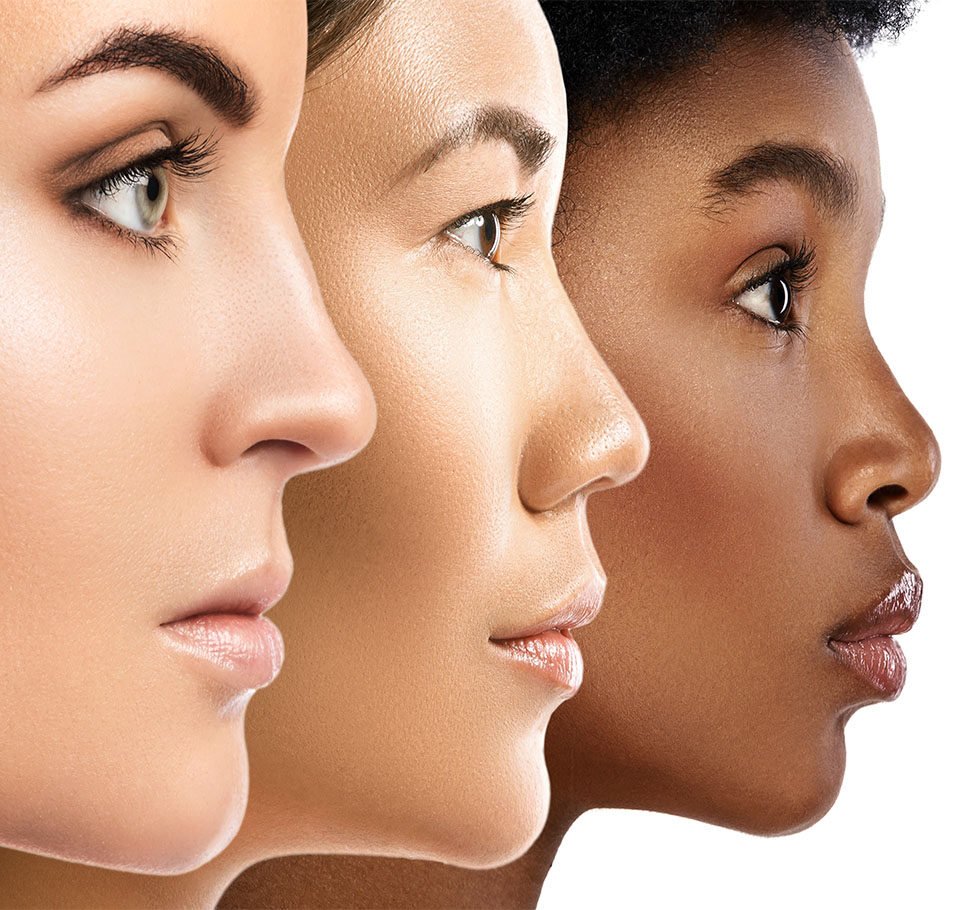 Non Surgical Nose Reshaping
